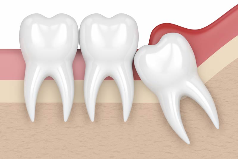 Periodontal Treatment in Chicago